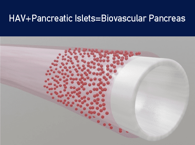 BioVascular Pancreas